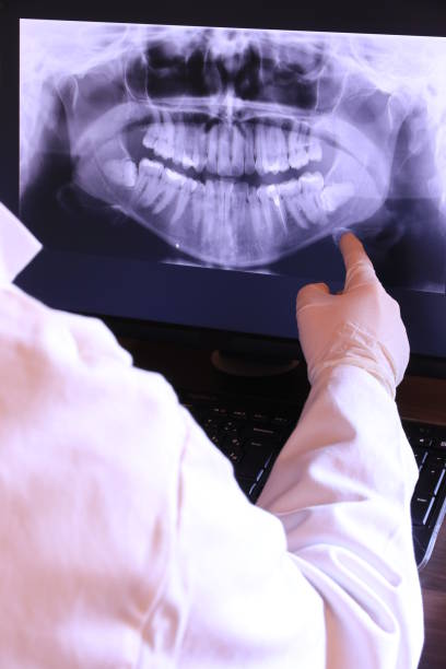 Best Chipped Tooth Repair Near Me  in Swartz Creek, MI